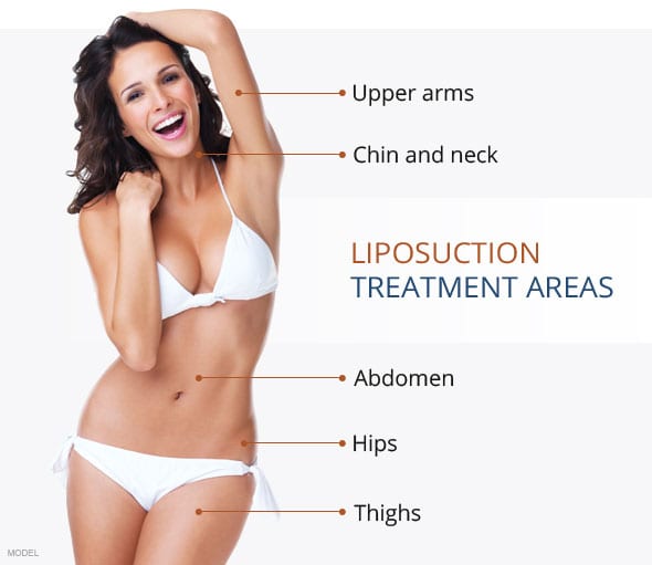 Liposuction Treatment Areas