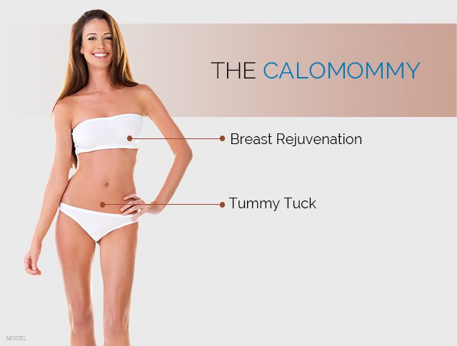 The CaloMommy includes breast rejuventation and tummy tuck